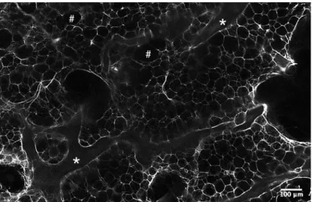 Figure 2.  Light-sheet microscopy analysis of human OA subchondral bone after the clearing protocol