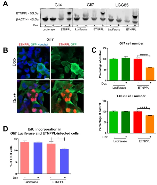 Figure 7.  Functional assessment of ETNPPL expression in glioblastoma cell lines. (A) WB for ETNPPL in  proteins extracted from Gli4, Gli7 and LGG85 cells infected with control (luciferase) or ETNPPL  inducible-lentiviruses and cultured with and without do