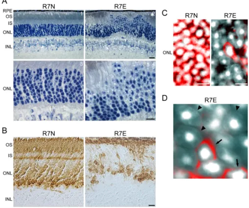 Figure 2. Chromatin Remodeling in Rod Nuclei Paralleled Segment Loss and Rho Down-Regulation in SCA7 Mice