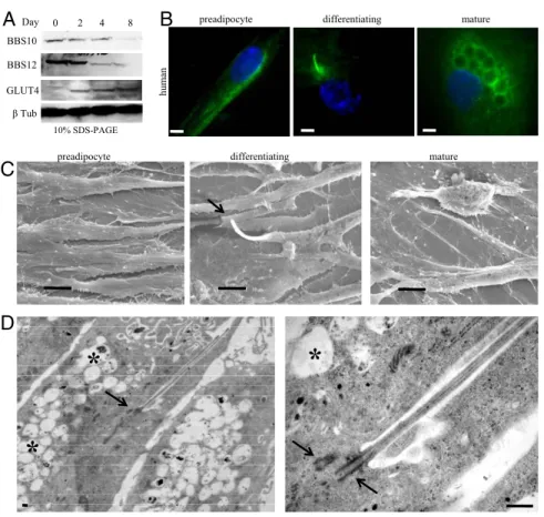 Fig. 2. Up-regulation of BBS10 and BBS12 proteins and transient presence of primary cilium in early  adi-pogenesis