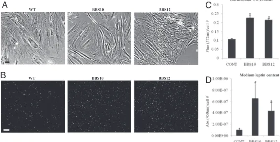 Fig. 6. Increased fat content in adipocytes derived from BBS patients’ fibroblasts. (A) Representative pictures of human dermal fibroblasts with the indicated gene mutation cultured in FGM (SI Text, Methods) to full confluence before adipogenic induction