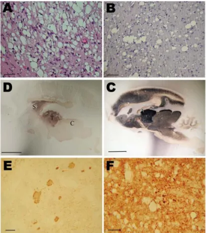 Figure 2. Histopathologic and disease-associated prion  protein (PrPd) immunodetection in the brain of 2  mouse lemurs after intracerebral (5 mg) or oral (50 mg)  inoculation with a cattle-derived L-type bovine spongiform  encephalopathy isolate