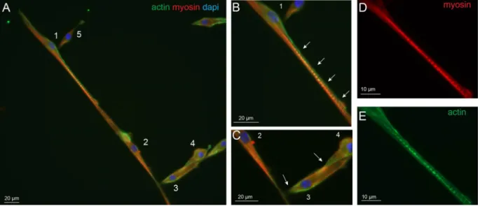 Figure 8.  Actin and myosin heavy chain gene expression of wildtype and SOD1 mutant myotubes