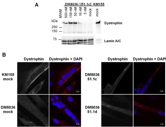 Fig 3. Analysis of dystrophin protein restoration. (A) Western blot analysis of total proteins extracted from cells derived from a healthy individual (KM155) and a DMD patient (DM8036)