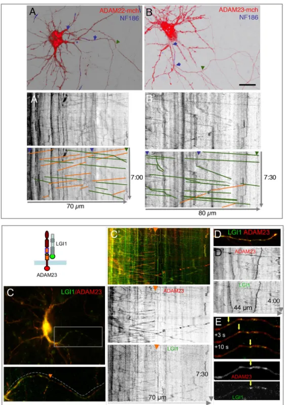 Fig. 6. LGI1 and ADAM23 are colocalized in transport vesicles.