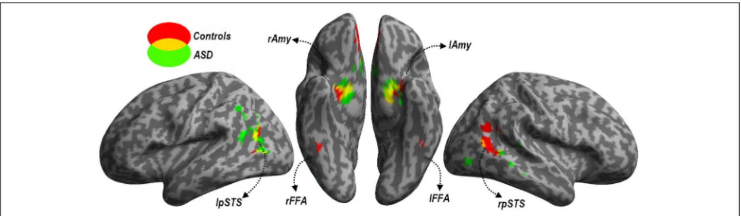 FIGURE 4 | Localizer session. Whole-brain maps showing significant increase of neural activity associated with the perception of Faces >