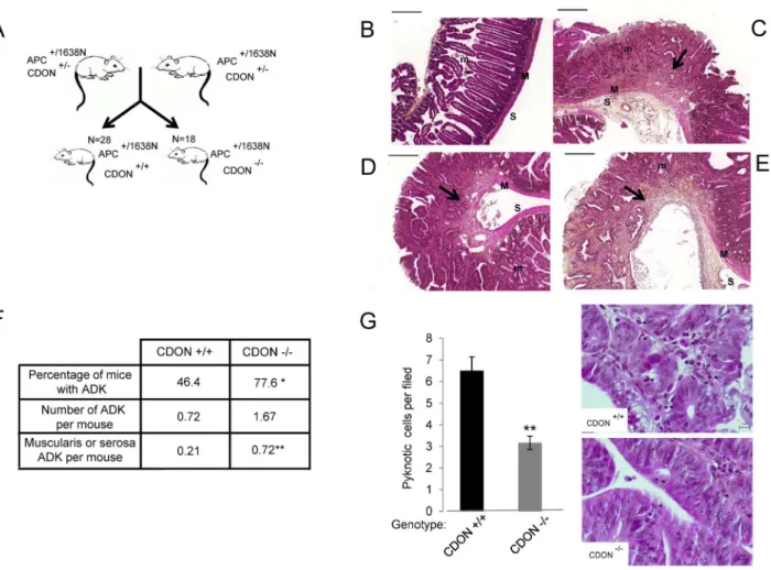 Figure 4. CDON is a bona fide tumor suppressor. (A) Cohorts of CDON 2/2 APC +/1638N mice were generated to analyze the effect of CDON genetic invalidation on intestinal tumorigenesis compared to CDON +/+ APC +/1638N 