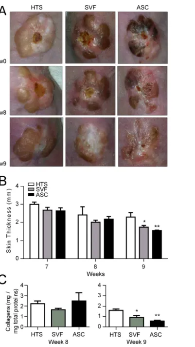 Fig 4. Reduction of hypertrophic scar after SVF or hASC injection in the hypertrophic scar humanized mouse model