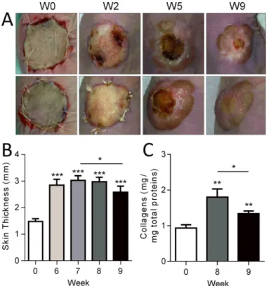 Fig 1. Human skin grafts in a humanized mouse model. (A) Macroscopic images of two examples of human skins (up and down panels) grafted onto the back of two immunocompromised Nude mice at different time points