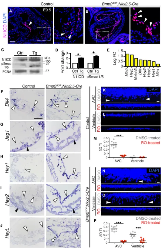 Fig. 3. Increased Notch1 activity in Bmp2 GOF ;Nkx2.5-Cre hearts is a prerequisite for ectopic EMT induction.