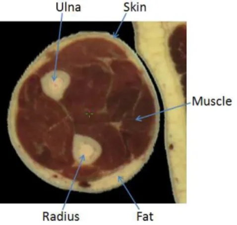 Figure 1. Tomographic image of a human forearm.