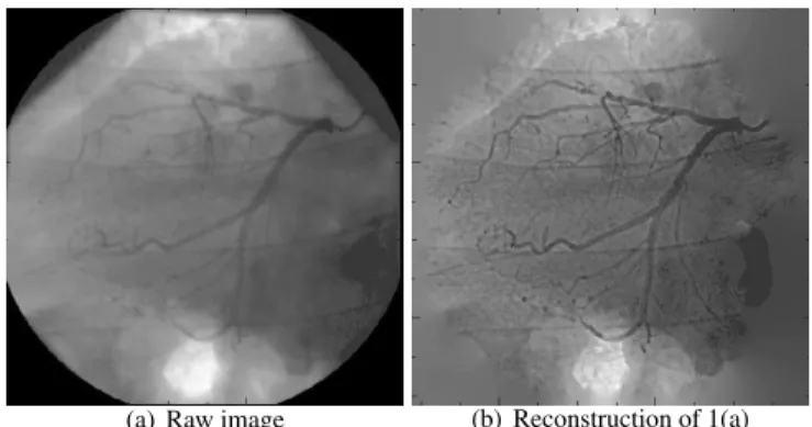 Fig. 2. Estimated PSF and weight map used for coronarography sequence shown in Fig. 1