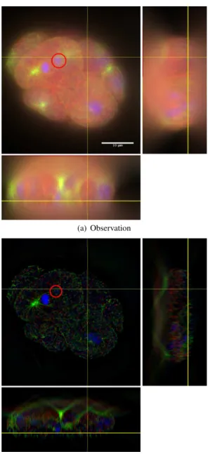 Fig. 3. C. Elegans embryo observation and the blind deconvolution result. Each panels are cuts in the 3D volume along the yellow lines.