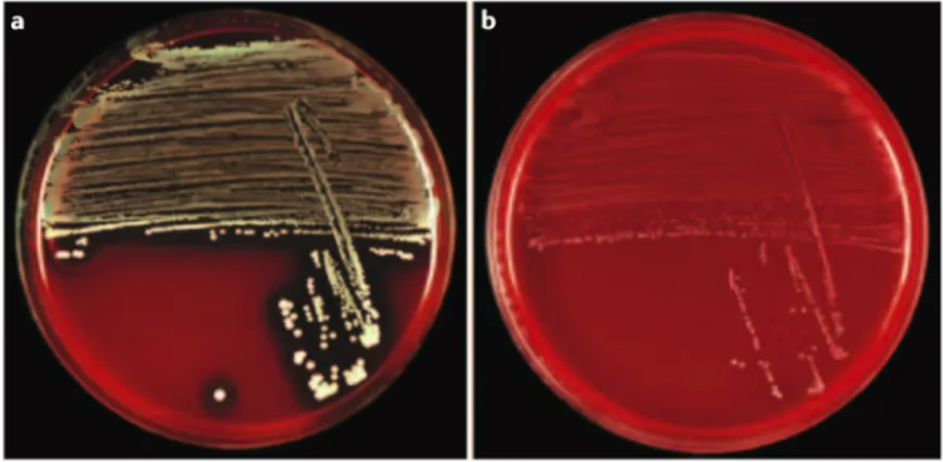 Figure 20. Aspect sur gélose au sang du phénotype usuel des colonies de S. aureus (à gauche) et du  phénotype  variant  microcolonie  (à  droite)