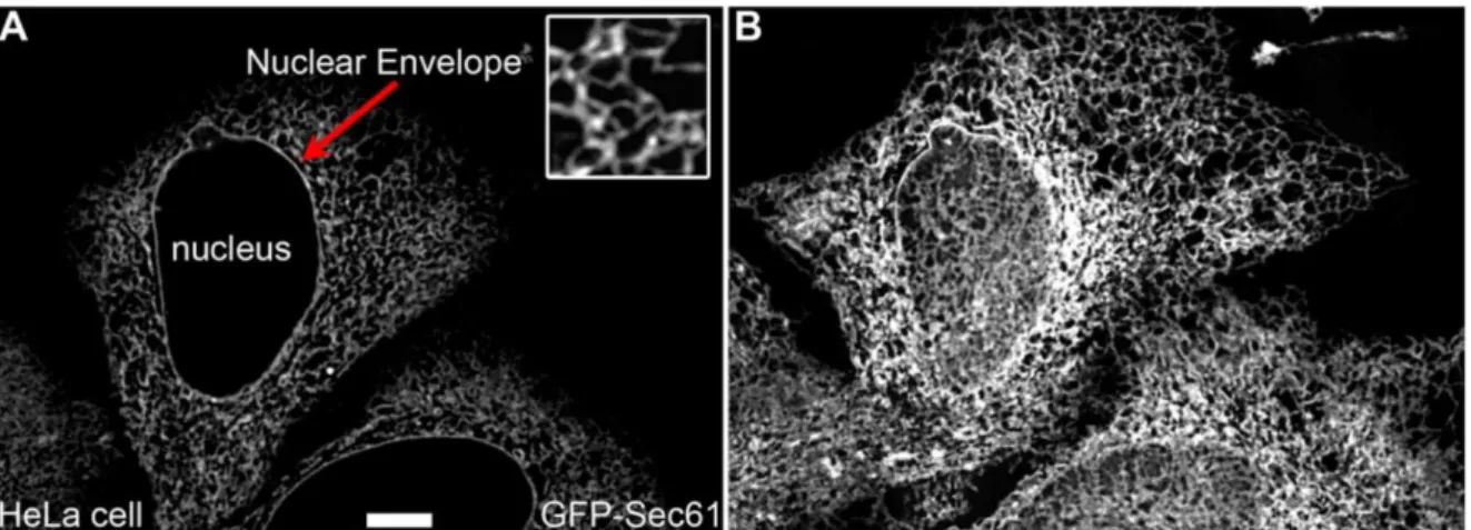 Figure 2. Structure du réticulum endoplasmique. (a) Images confocales de cellules HeLa exprimant GFP-Sec61