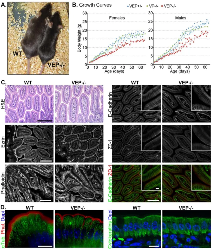Figure 12: The VEP −/−  mice have growth defects, but the morphology of their intestinal epithelium looks  normal