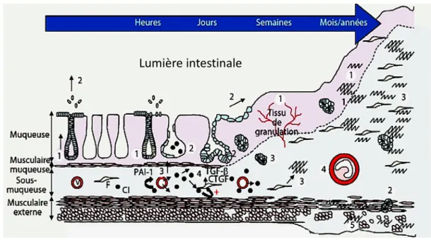 Figure 9 : Etapes du développement de la fibrose digestive radio-induite (d’après François et al