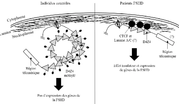 FIGURE 14. Modèle de localisation nucléaire de la région subtélomérique 4q35 chez des individus  contrôles et des patients FSHD