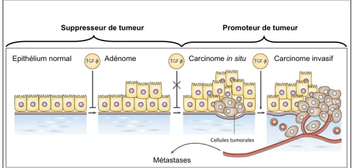 Figure 5: Rôle biphasique du TGF-β dans les cancers  (d’après Siegel et al, 2003)    Le TGF-β, notamment par ses effets prolifératifs et pro-apoptotiques, a un effet  anti-tumoral  dans  les  premiers  stades  de  la  cancérogenèse