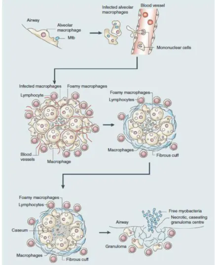 Figure 3.  Schéma de l’infection par les bacilles tuberculeux dans le macrophage (Russell,  Cardona et al