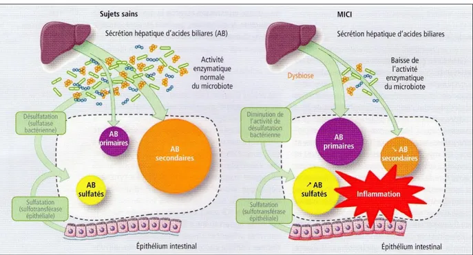 Figure 4. Dysmétabolisme des acides biliaires au cours des MICI  D’après Duboc et al[9] 