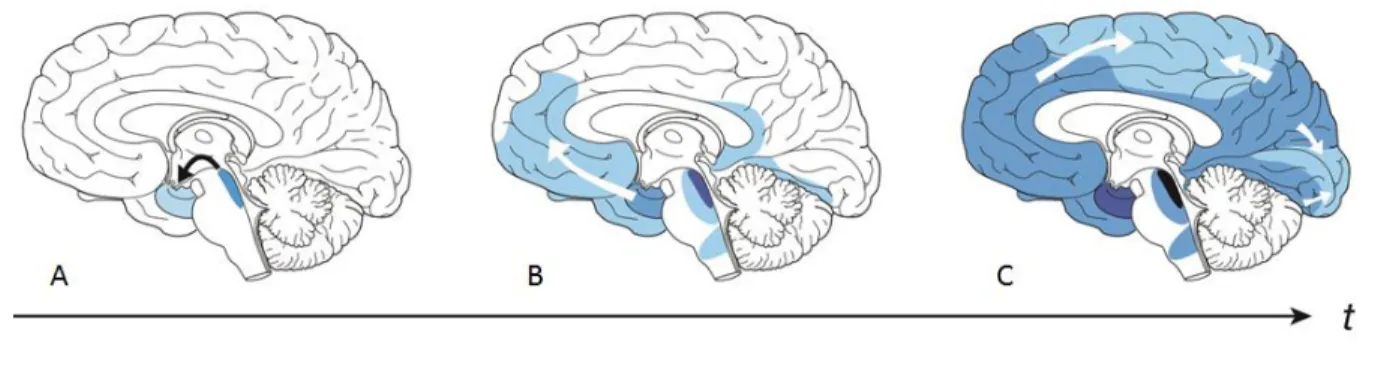 Figure 7: Distribution de la pathologie Tau dans le cerveau aux différents stades de la maladie