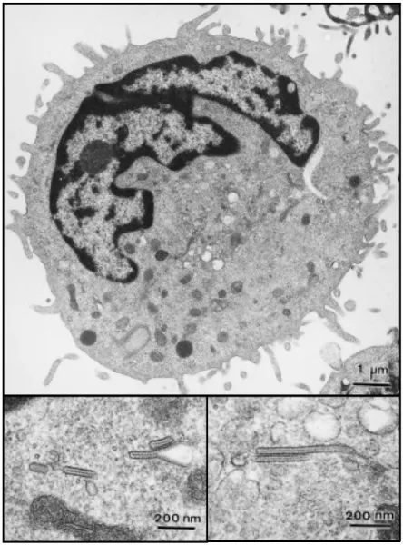 Figure 5 : Microscopie électronique d’une cellule de Langerhans avec visualisation  des granules de Birbeck (Dr Schmitt et Dr De Zutter Inserm U.346) 