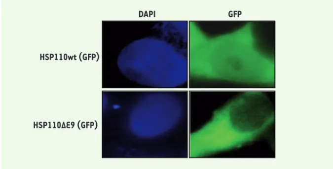 Figure 1.  Expression de la protéine chaperon HSP110 dans la cellule tumorale colique