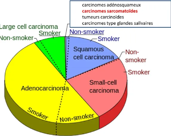 Figure 1 : répartitions des sous-types de carcinomes bronchiques 