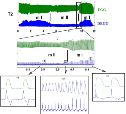 Figure 1.9 – Visualisation des signaux électroglottographiques (EGG et sa dérivée, DEGG) lors d’un glissando effectué par un tenor