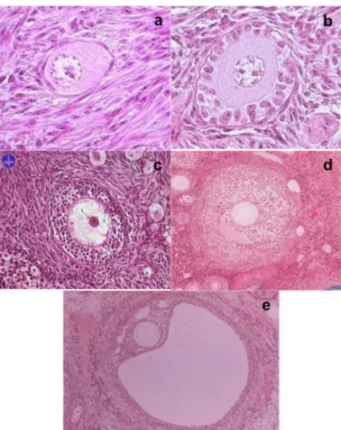 Figure 7 :  Coupes histologiques des différentes types morphologiques folliculaires : a)  follicule  primaire;  b)  follicule  primaire;  c)  follicule secondaire;  d)  follicule  antral (début antrum) et e) follicule pré ovulatoire ou follicule de De Graa
