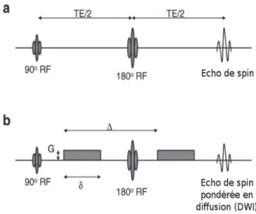 Figure  1  :  Représentation  schématique  de  l'écho  de  spin  par :  a.  L'application  d'impulsions de radiofréquence de 90° et 180°, avec sa formes d'écho à la fin du temps  de écho (TE)