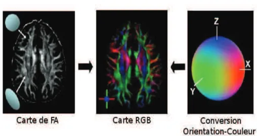 Figure 9 : Une carte de FA peut être réalisée à partir de la forme dans laquelle les  régions sombres sont isotropes (sphériques) et les régions brillantes sont anisotropes  (allongées)