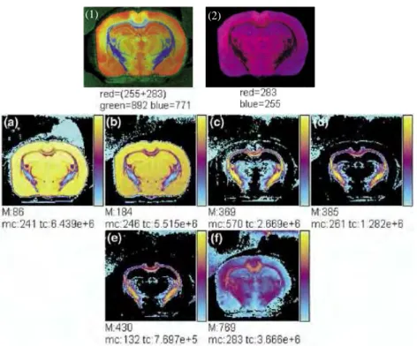 Figure  I.2.6 :  Localisation  de  plusieurs  lipides  sur  une  coupe  de  cerveau  de  rat,  obtenues par imagerie SIMS utilisant des clusters Bi 3