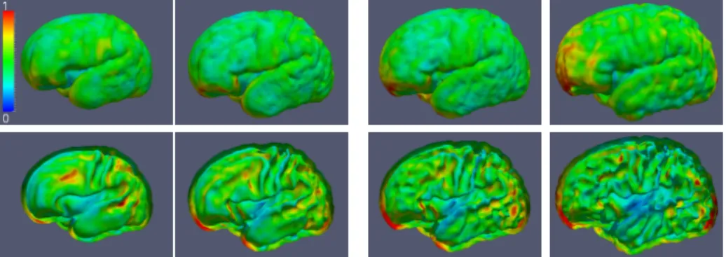 Figure 2.4: Average cortical surfaces of A τ n estimated at different times τ n using spatio-temporal averaging on tangent spaces (second algorithm)