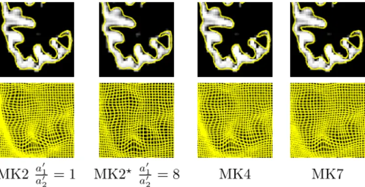 Figure 2.7: Registration results obtained on the example of Fig. 2.6 using multi- multi-scale kernels