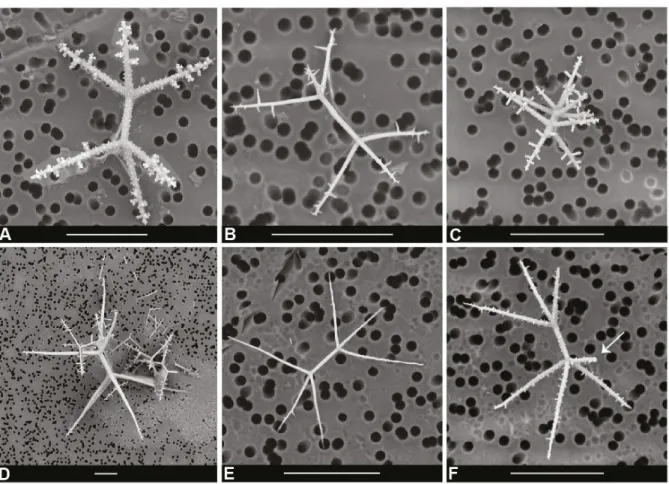 Figure S2. Intraspecific variability of silicified spicules within the Sphaerozoidae. Scanning  Electron  Microscopy  images  from  the  exact  same  specimens  used  for  the  molecular  phylogenetic analysis in this study: (A-D) Sphaerozoum armatum (Pac 