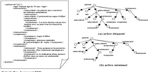 Fig. 2 – Exemple d’un document XML avec sa représentation en arbre et sa représentation réduite  