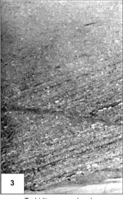 Figure A.2 : Exemples de faciès gravitaires dans la Craie de la Mer du Nord d'après Kennedy (1987) pour les photos 1 à 3, et Damholt et Surlyk (2004) pour la photo 4.