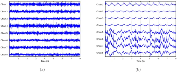 Fig. 2.19 – Signaux obtenus par simulation à partir du modèle I (a) et du modèle II (b) 