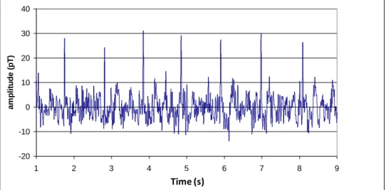Figure 24 : Raw MCG signal recorded on a Nb-mixed sensor with a thermal noise of 100 fT/√Hz