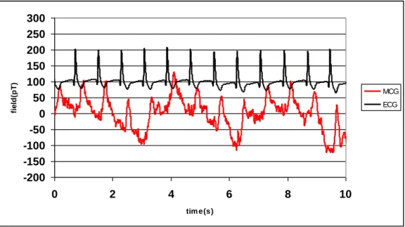 Figure 26 : Raw ECG (black) and MCG (red) data recorded simultaneously. The strong oscillation in the MCG corresponds  to the breathing of the subject