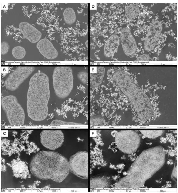 Fig. 2. Transmission electron microscopy images of Salmonella typhimurium TA 102 after TiO 2 -P25 (A, B, D, and E) and TiO 2 -TLB exposure (C and F) in the exposure medium of the bacterial reverse mutation test (A–C) and in the NaCl saline solution (D–F).