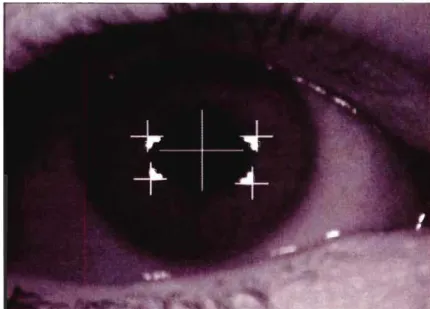 Figure 2.12 Image de Purkinje avec plusieurs patterns d'illumination [16]. 