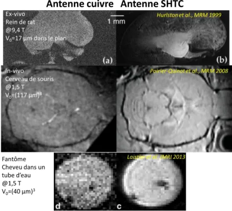 Figure  I.7 :  Comparaison  d’images  acquises  avec  des  antennes  en  cuivre  et  des  antennes  en  matériau  supraconducteur (Hurlston et al., 1999; Laistler et al., 2013; Poirier-Quinot et al., 2008)