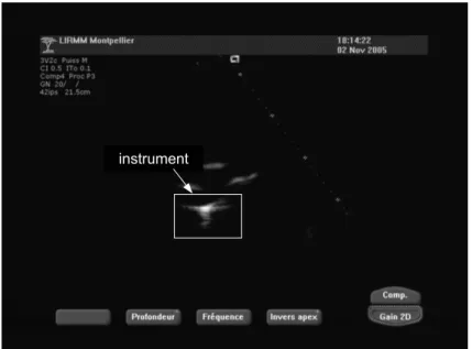 Fig. 1.18  Image de l'instrument ave un gain de 20 dB