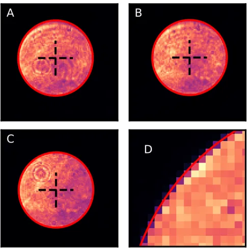 Figure 3.6: Ajustements elliptiques obtenus pour les quatre quadrants, su- su-perposés à l’image 4-tilts initiale