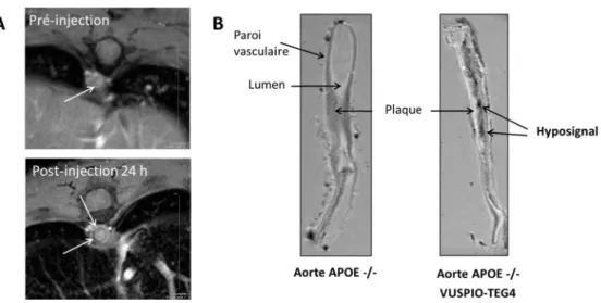 Figure I.27 : A : Image en IRM présentant une section de l’aorte thoracique de souris APOE‐/‐ 