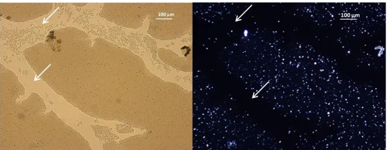 Figure III.19 : images de microscopie optique  d‘un système G 120  âgé de dix jours : à gauche,  sous lumière naturelle ; à droite, sous lumière polarisée 