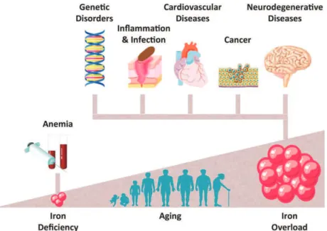 Figure 2 : Représentation schématique du statut en fer de l’organisme en fonction de pathologies caractéristiques